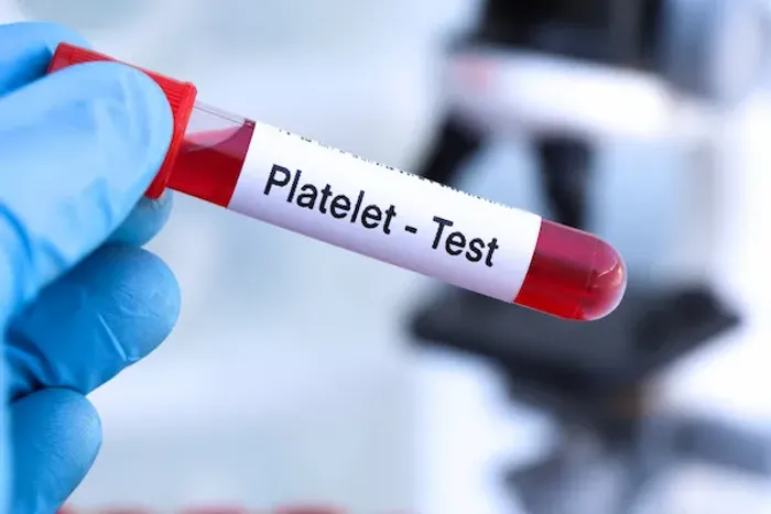 PLATELET COUNT